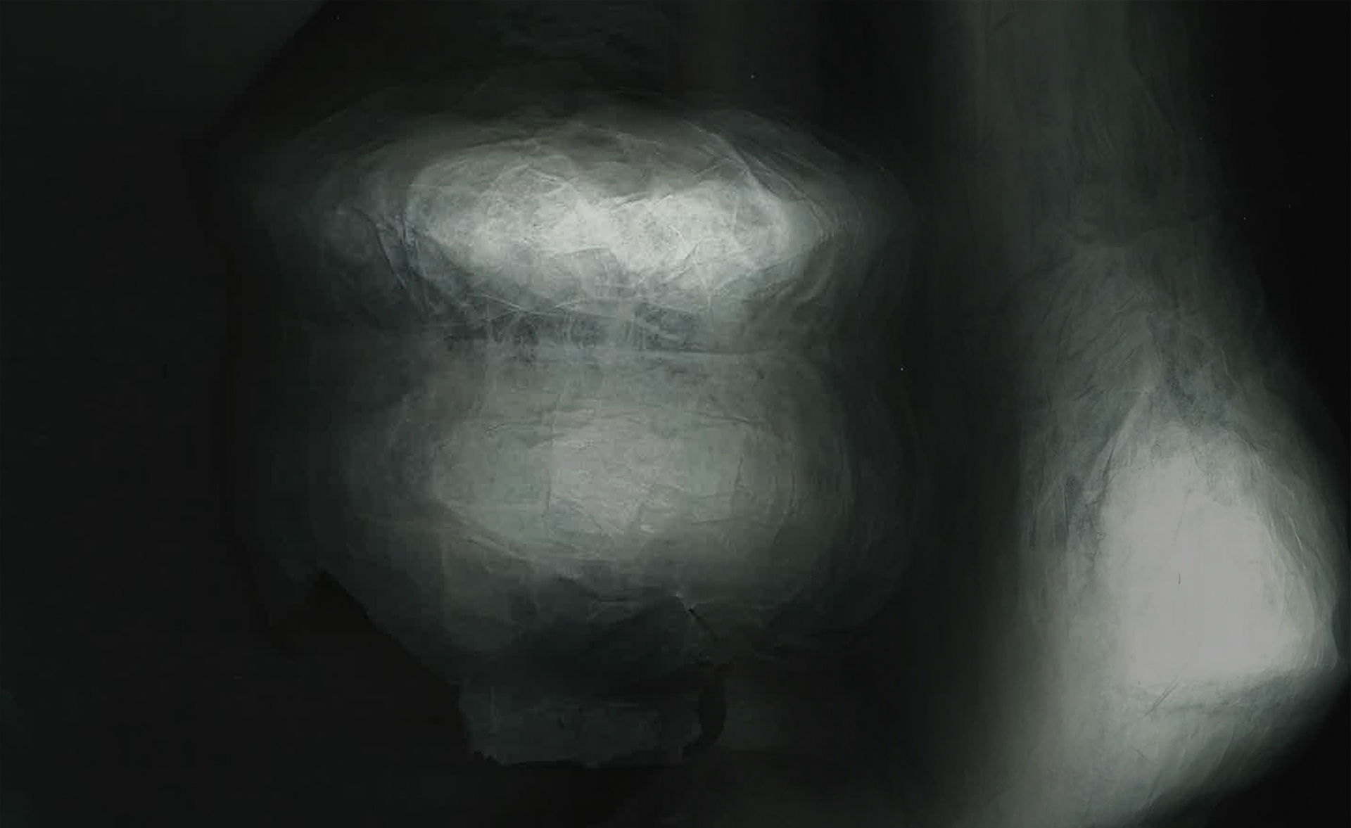 scan of vessel interior